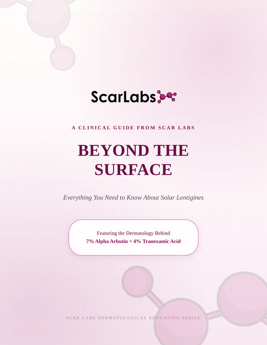 ScarLabs™ Beyond the Surface: A Guide to Solar Lentigines (35 Pages)