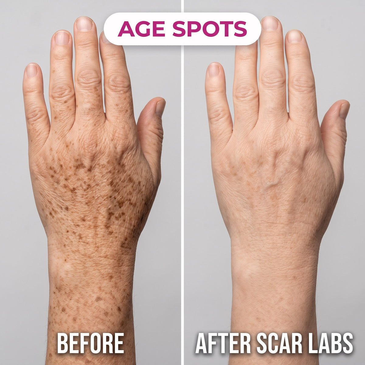 ScarLabs™ Age Spot Corrector (Dual-Action Formula)