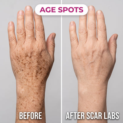 ScarLabs™ Age Spot Corrector (Dual-Action Formula)